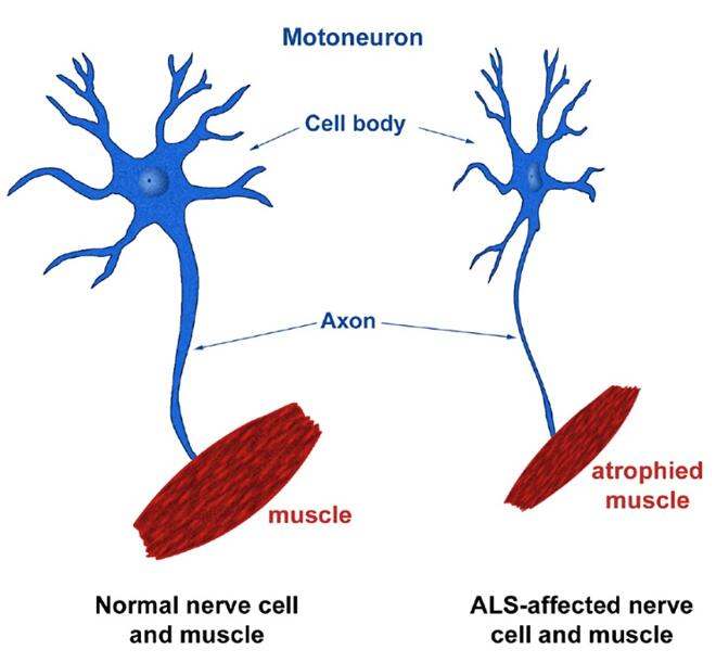 Neuromuscular Co-culture ALS Models