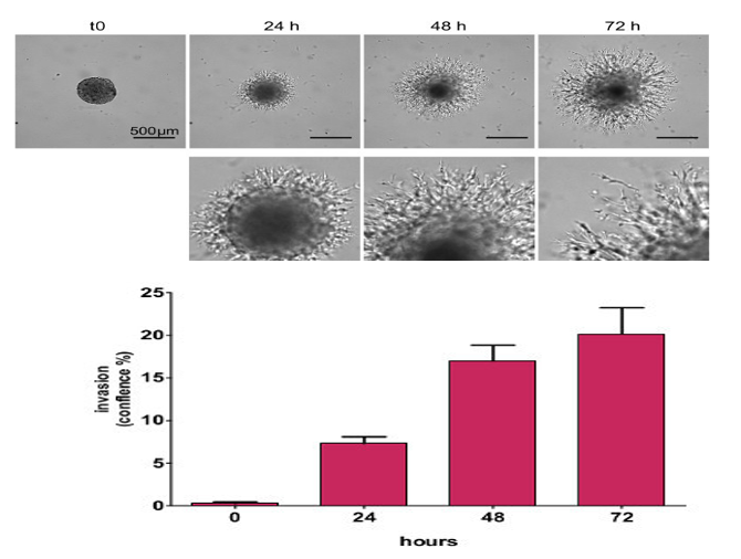 Three-Dimensional Spheroid (3D) Invasion Assay