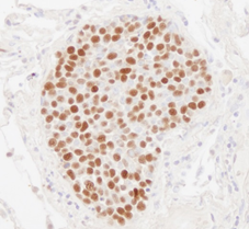 Immunoassay for cell proliferation