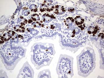 Cell Proliferation Assay By DNA Synthesis