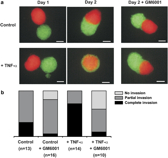 Spheroid Confrontation Assay