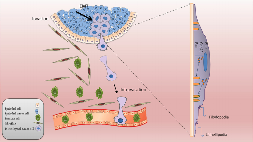 Features of tumor cell invasion