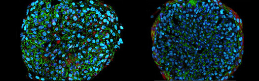 Three-Dimensional (3D) Spheroid Assay