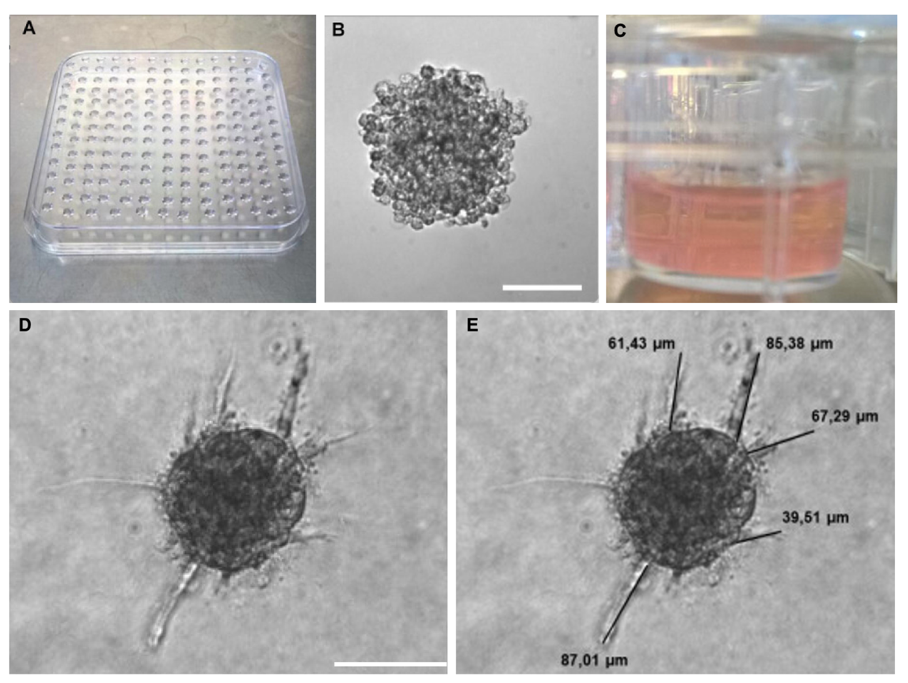 The procedure of 3D angiogenesis assay.