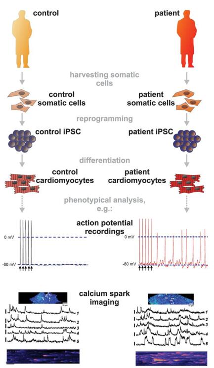 Modeling cardiac diseases with patient-specific induced pluripotent stem cells (iPSC).