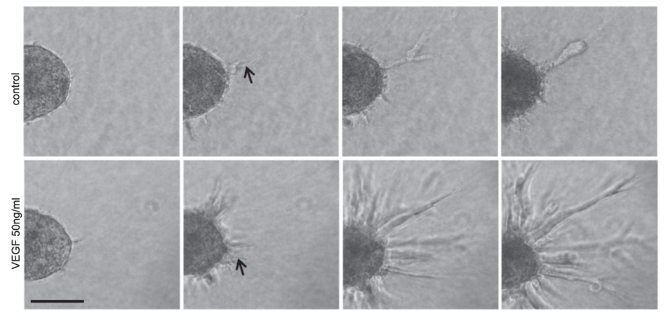 Time-lapse video microscopy images (20 hours) of human umbilical vein endothelial cell (HUVEC) spheroid sprouting. HUVEC spheroids were seeded in collagen gels and treated with or without 50 ng/ml VEGF. Scale bar, 100 µm.