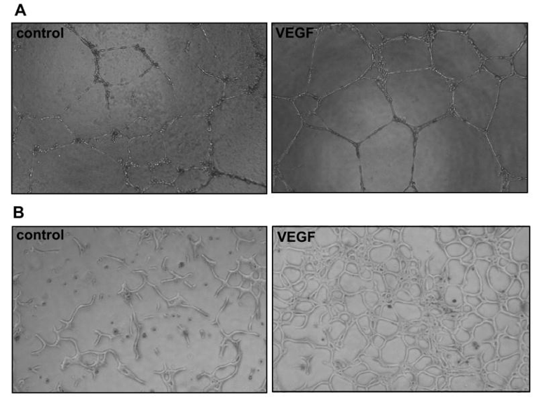 Tube formation assay. Human umbilical vein endothelial cells (A) and bovine aortic endothelial cells (B) were plated on Matrigel and cultured in the absence or presence of VEGF (10 ng/ml).