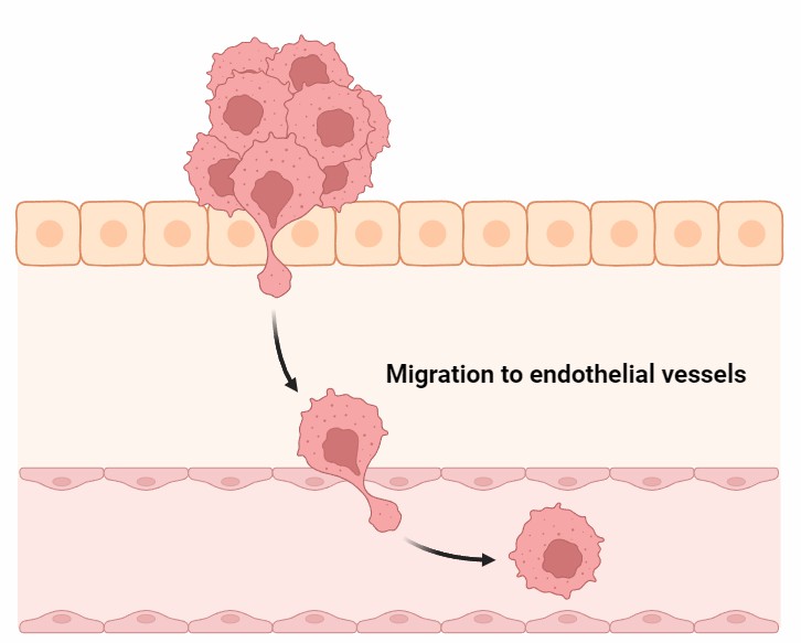Tumor Cell Migration