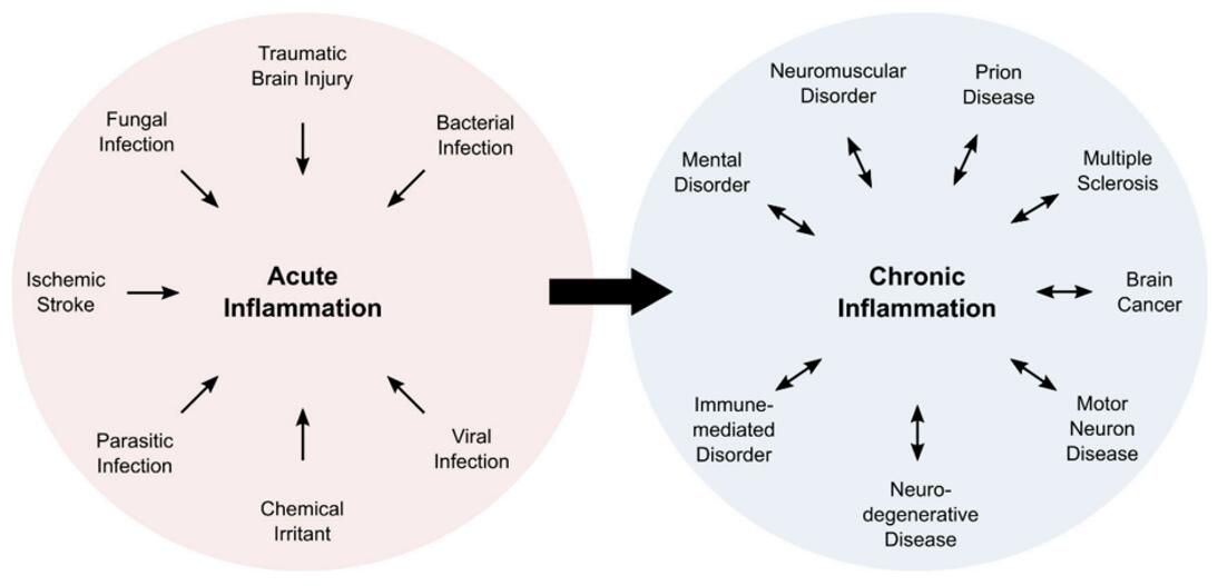 Overview of cause and consequence of acute and chronic inflammation. Acute inflammation is induced in response to external factors. Persisting inflammatory responses become chronic events that are associated with numerous pathologies.