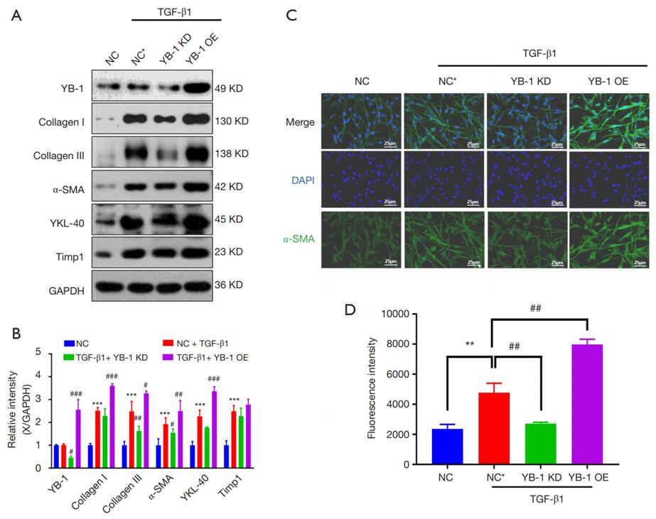 YB-1 promoted liver fibrosis in a model of TGF-Beta1–induced HSC.