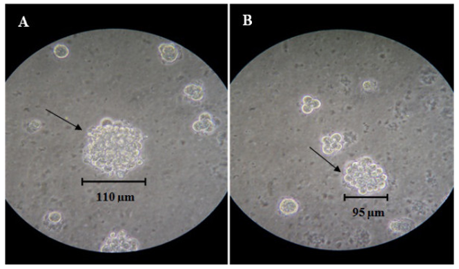 Colony formation of the MBC1 (A) and MBC2 (B) cell lines in soft agar at 14 Days post seeding. Magnification, 10X.