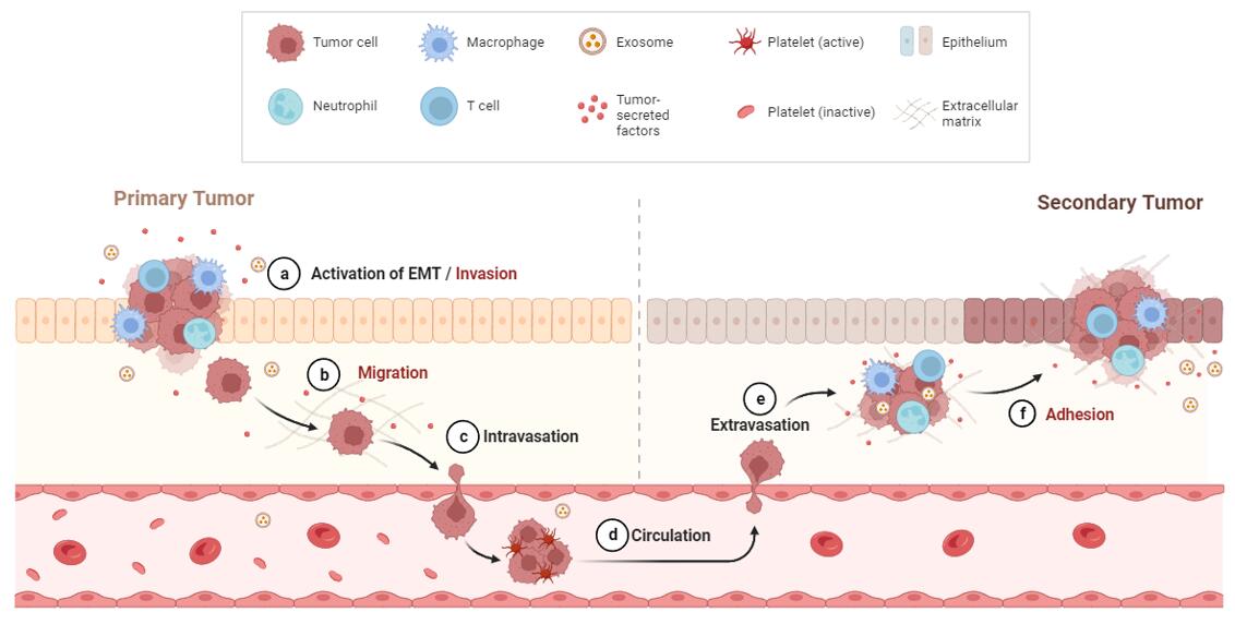 The sequential steps in the pathogenesis of metastasis
