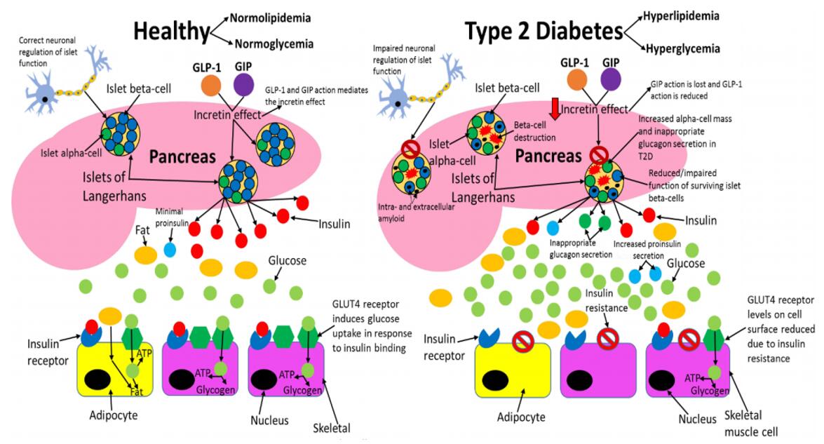 Comparing healthy and type 2 diabetic phenotypes.